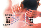 ޻(jng)i׵|(qing)]ܵĹǲ 
P(gun)I: